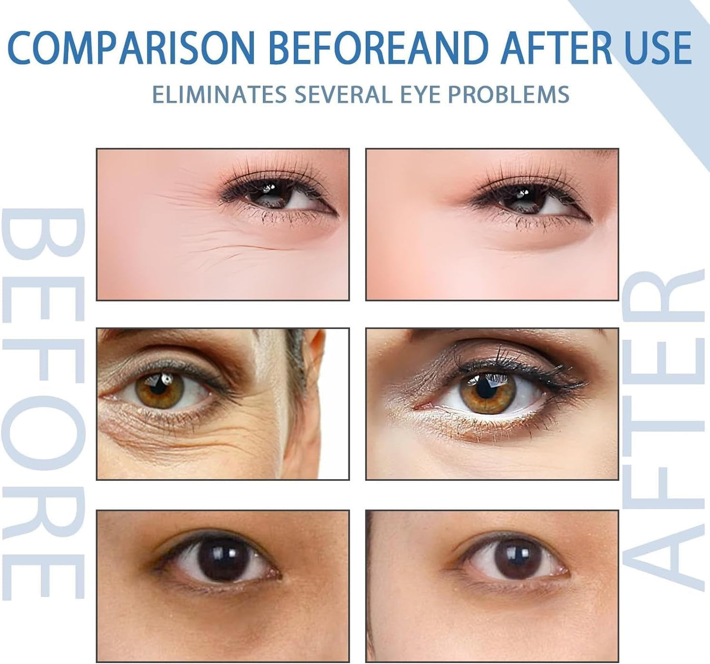 Peptide Depuffing Eye Serum, Awaken Peptide Lifting Eye Gel, Anti-Aging Moisturizing Eye Cream Reduces Puffiness, Remove Eye Bags, Wrinkles, Dark Circles, 20G (1Pcs)