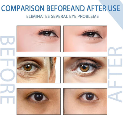 Peptide Depuffing Eye Serum, Awaken Peptide Lifting Eye Gel, Anti-Aging Moisturizing Eye Cream Reduces Puffiness, Remove Eye Bags, Wrinkles, Dark Circles, 20G (1Pcs)